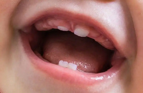 Odontopediatria