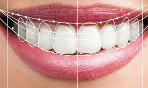 Odontologia Estetica